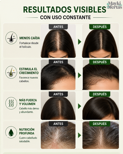 OUHOE - SPRAY CAPILAR